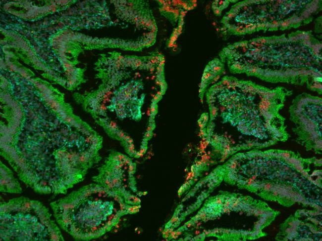 CellMask Green Actin Tracking Stain labeling in IHC protocol